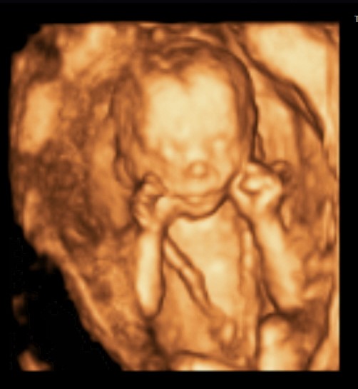 🎉 Cheapest 3d ultrasound near me | List of 3D Ultrasound ...
