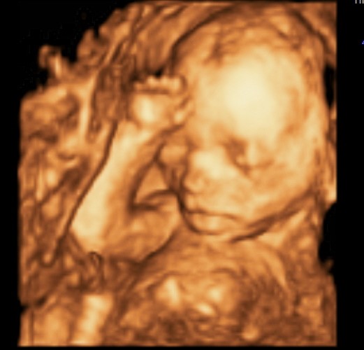 Prices and Packages | 3D Elective Ultrasound | 4D Elective Ultrasound ...